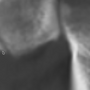 spectacle.ns5169.png
